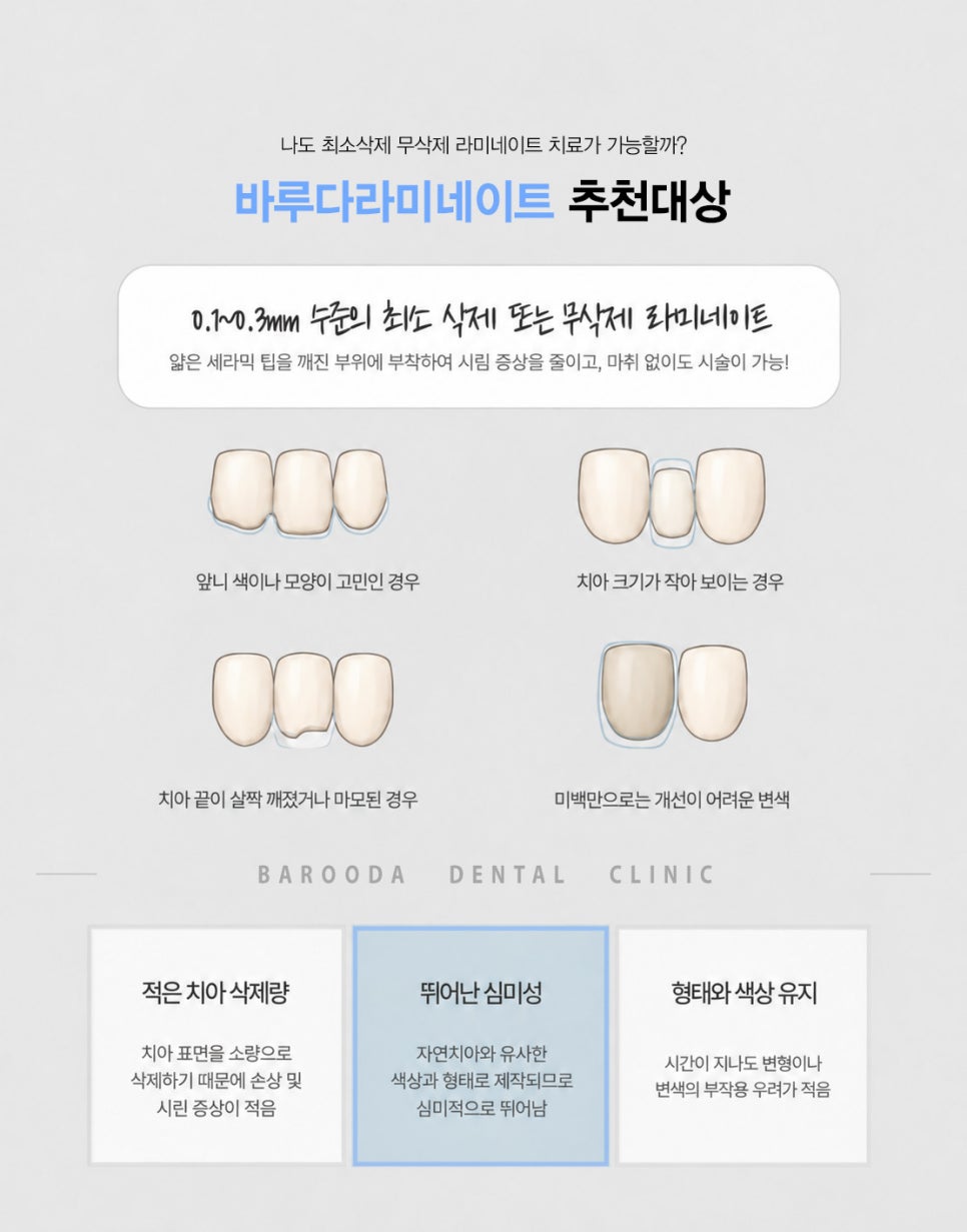 라미네이트 추천대상