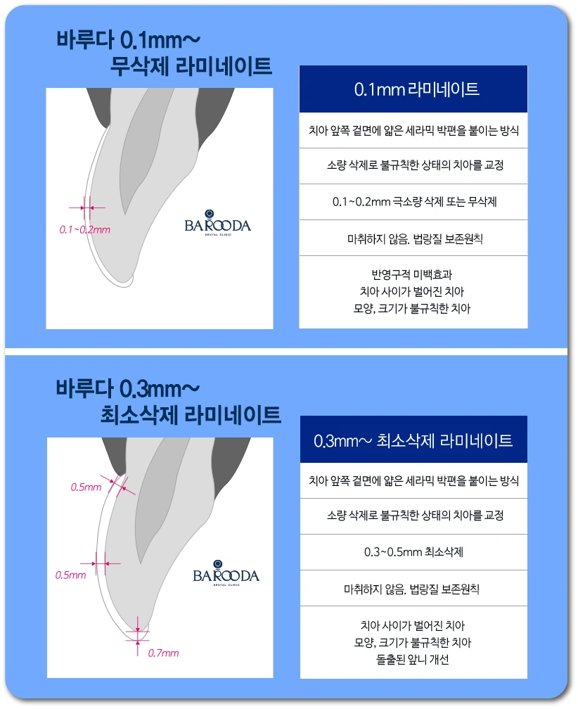 라미네이트 설명