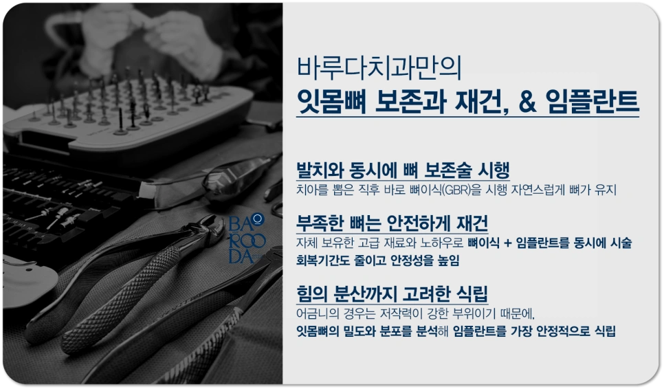 기존 임플란트를 제거하고 다시 심을 수 있나요? - 바루다치과의원